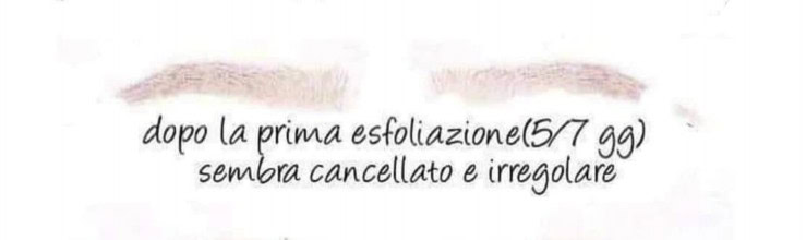 settimana-dopo-microbalding